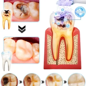 𝐎𝐲𝐢𝐤𝐞𝐲™ 𝐓𝐞𝐞𝐭𝐡 𝐑𝐞𝐬𝐭𝐨𝐫𝐚𝐭𝐢𝐨𝐧 𝐏𝐨𝐮𝐝𝐫𝐞 𝐌𝐢𝐧é𝐫𝐚𝐥𝐞👨‍⚕️(𝐑𝐞𝐜𝐨𝐦𝐦𝐚𝐧𝐝é 𝐩𝐚𝐫 𝐀𝐬𝐬𝐨𝐜𝐢𝐚𝐭𝐢𝐨𝐧 𝐃𝐞𝐧𝐭𝐚𝐢𝐫𝐞 𝐅𝐫𝐚𝐧ç𝐚𝐢𝐬𝐞)💎💎💎 𝐎𝐲𝐢𝐤𝐞𝐲™ 𝐓𝐞𝐞𝐭𝐡 𝐑𝐞𝐬𝐭𝐨𝐫𝐚𝐭𝐢𝐨𝐧 𝐏𝐨𝐮𝐝𝐫𝐞 𝐌𝐢𝐧é𝐫𝐚𝐥𝐞