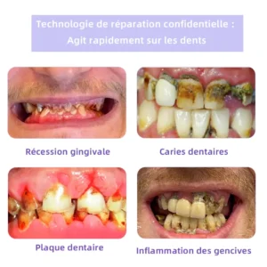 𝐎𝐲𝐢𝐤𝐞𝐲™ 𝐓𝐞𝐞𝐭𝐡 𝐑𝐞𝐬𝐭𝐨𝐫𝐚𝐭𝐢𝐨𝐧 𝐏𝐨𝐮𝐝𝐫𝐞 𝐌𝐢𝐧é𝐫𝐚𝐥𝐞👨‍⚕️(𝐑𝐞𝐜𝐨𝐦𝐦𝐚𝐧𝐝é 𝐩𝐚𝐫 𝐀𝐬𝐬𝐨𝐜𝐢𝐚𝐭𝐢𝐨𝐧 𝐃𝐞𝐧𝐭𝐚𝐢𝐫𝐞 𝐅𝐫𝐚𝐧ç𝐚𝐢𝐬𝐞)💎💎💎 𝐎𝐲𝐢𝐤𝐞𝐲™ 𝐓𝐞𝐞𝐭𝐡 𝐑𝐞𝐬𝐭𝐨𝐫𝐚𝐭𝐢𝐨𝐧 𝐏𝐨𝐮𝐝𝐫𝐞 𝐌𝐢𝐧é𝐫𝐚𝐥𝐞