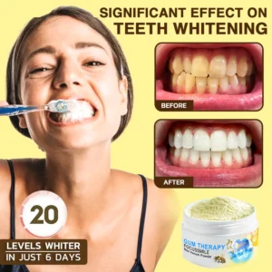 🐝𝐎𝐲𝐢𝐤𝐞𝐲™ Focussmile Bee Venom Treatment Oral Powder 🦷 (🇦🇺 TGA-Certified)