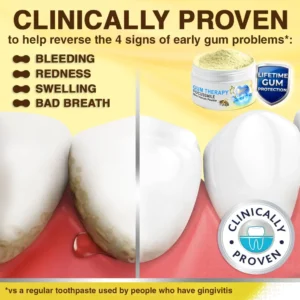 🐝𝐎𝐲𝐢𝐤𝐞𝐲™ Focussmile Bee Venom Treatment Oral Powder 🦷 (🇦🇺 TGA-Certified)