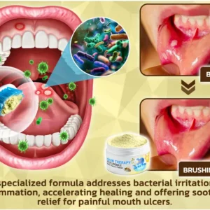🐝𝐎𝐲𝐢𝐤𝐞𝐲™ Focussmile Bee Venom Treatment Oral Powder 🦷 (🇦🇺 TGA-Certified)