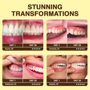 🐝𝐎𝐲𝐢𝐤𝐞𝐲™ Focussmile Bee Venom Treatment Oral Powder 🦷 (🇦🇺 TGA-Certified)