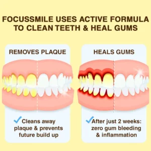 🐝𝐎𝐲𝐢𝐤𝐞𝐲™ Focussmile Bee Venom Treatment Oral Powder 🦷 (🇦🇺 TGA-Certified)