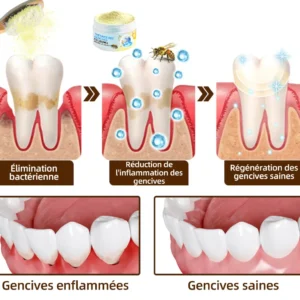 𝐎𝐲𝐢𝐤𝐞𝐲™ Focussmile Poudre de Thérapie Gingivale au Venin d'Abeille