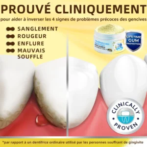 𝐎𝐲𝐢𝐤𝐞𝐲™ Focussmile Poudre de Thérapie Gingivale au Venin d'Abeille