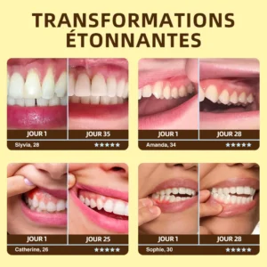 𝐎𝐲𝐢𝐤𝐞𝐲™ Focussmile Poudre de Thérapie Gingivale au Venin d'Abeille