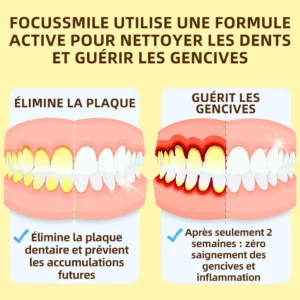 𝐎𝐲𝐢𝐤𝐞𝐲™ Focussmile Poudre de Thérapie Gingivale au Venin d'Abeille
