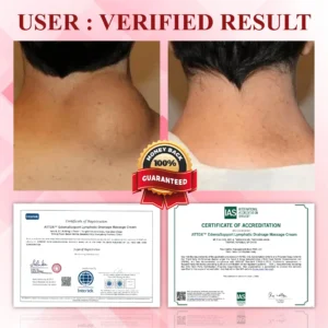 ATTDX™ EdemaSupport Lymphatic Drainage Massage Cream AP