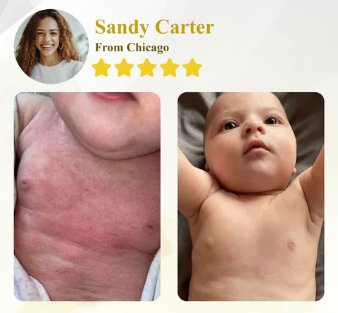 Apis Venom Multi-Skin Healing Cream