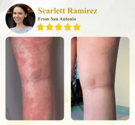 Apis Venom Multi-Skin Healing Cream