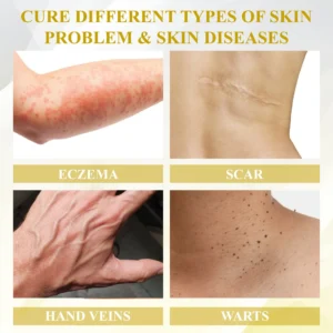 ApisClear™ Apis Venom Multi-Skin Healing Cream