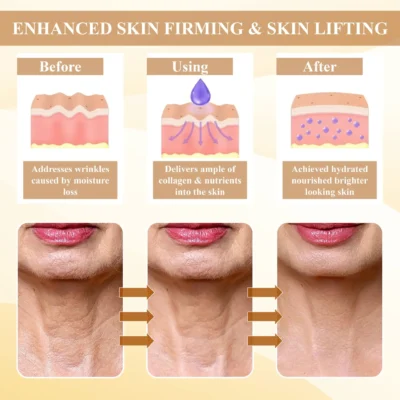 ApisDerm™ Royal Jelly Multi-Action BeeFirming Cream