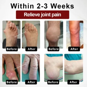 ArthroCareX™ Horse Chestnut Joints and Muscles Massage Gel AP