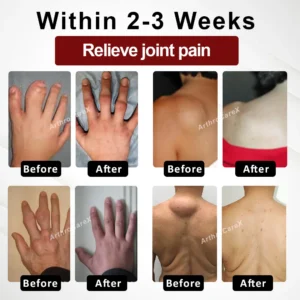 ArthroCareX™ Horse Chestnut Joints and Muscles Massage Gel AP