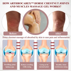 ArthroCareX™ Horse Chestnut Joints and Muscles Massage Gel AP