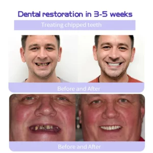 BBOJI™ (ADA recommended) Teeth Restoration Mineral Powder