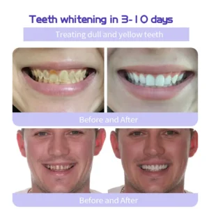 BBOJI™ (ADA recommended) Teeth Restoration Mineral Powder