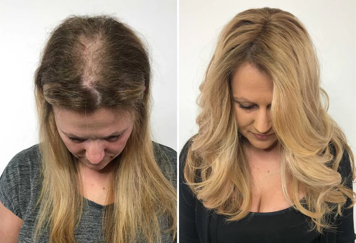Biancat™ Biotin Hair Growth Premium Serum