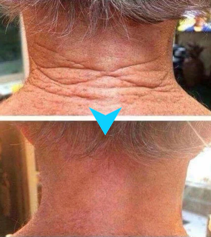 Biancat™ LuxeLift Skin Firming Youth Butter🔥Best-Selling