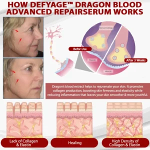 DefyAge™ Dragon Blood Advanced RepairSerum