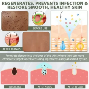 DermaEase™ Spotless Tag and WartRemoval Gel