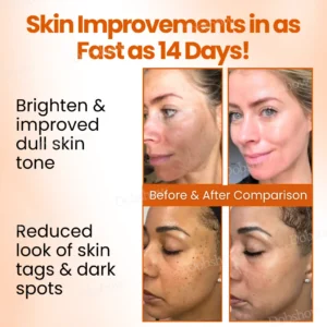 Dobshow™ SpotErase Trio Vitamin C 20% Removal Cream