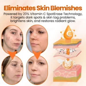 Dobshow™ SpotErase Trio Vitamin C 20% Removal Cream