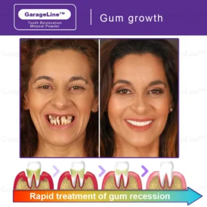GarageLine™ TeethRestoration Mineral Powder (ADA recommended)