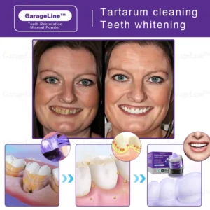 GarageLine™ TeethRestoration Mineral Powder (ADA recommended)