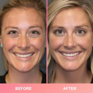 LIMETOW™ Compact Anti-Wrinkle Bar