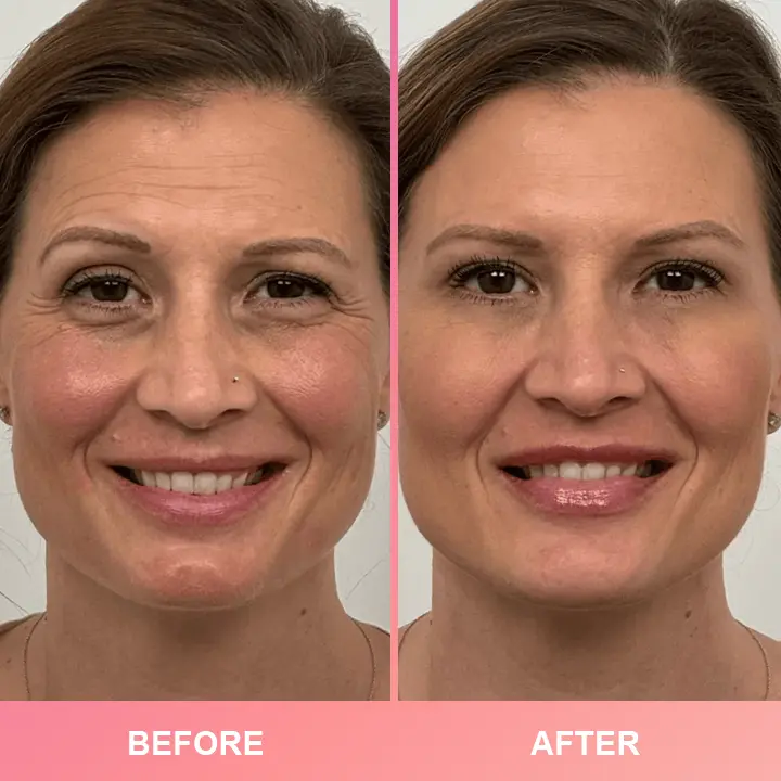 LIMETOW™ Compact Anti-Wrinkle Bar