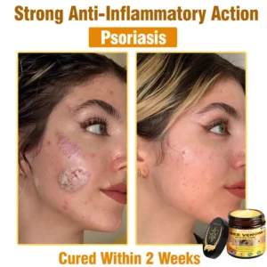 LOVILDS™ Bee Venom All-in-One Cream (US Dermatologist Approved)
