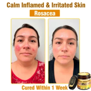 LOVILDS™ Bee Venom All-in-One Cream (US Dermatologist Approved)