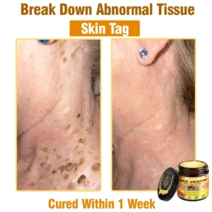LOVILDS™ Bee Venom All-in-One Cream (US Dermatologist Approved)
