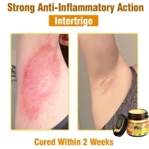 LOVILDS™ Bee Venom All-in-One Cream (US Dermatologist Approved)