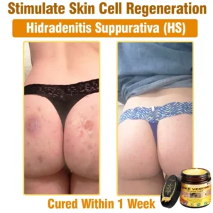 LOVILDS™ Bee Venom All-in-One Cream (US Dermatologist Approved)