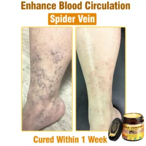 LOVILDS™ Bee Venom All-in-One Cream (US Dermatologist Approved)