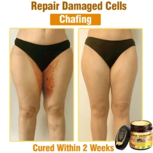 LOVILDS™ Bee Venom All-in-One Cream (US Dermatologist Approved)