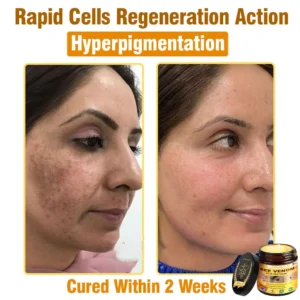 LOVILDS™ Bee Venom All-in-One Cream (US Dermatologist Approved)