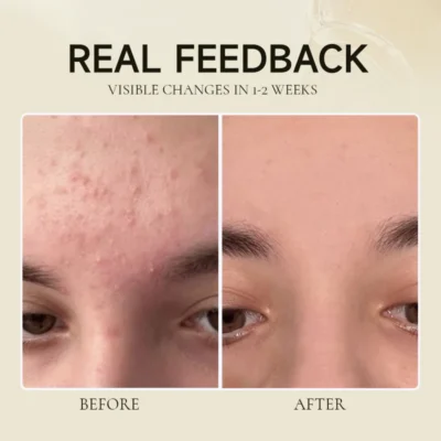 Lovilds™ Fermented Soy Exfoliating Antioxidant Hydrating Elasticity Essence