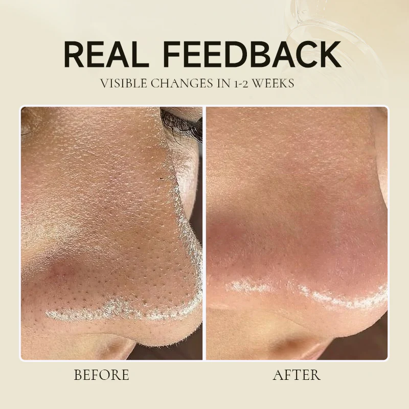 Lovilds™ Fermented Soy Exfoliating Antioxidant Hydrating Elasticity Essence