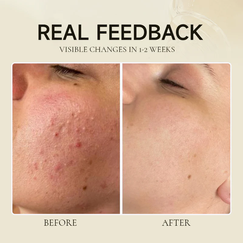 Lovilds™ Fermented Soy Exfoliating Antioxidant Hydrating Elasticity Essence