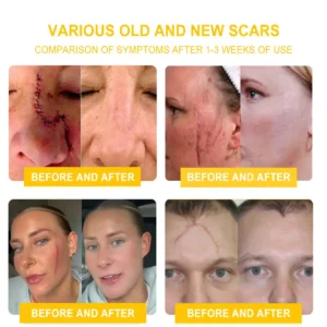 NESLEMY™ Bee Venom Skin Cream（👨‍⚕AAD Recommended)