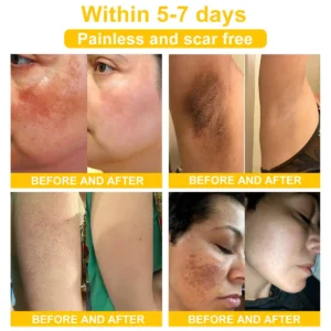 NESLEMY™ Bee Venom Skin Cream（👨‍⚕AAD Recommended)