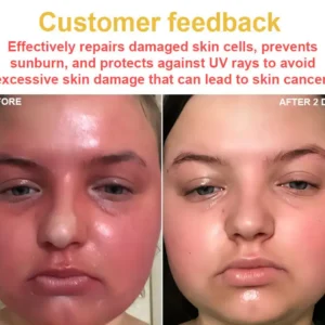 NESLEMY™ Bee Venom Skin Cream（👨‍⚕AAD Recommended)