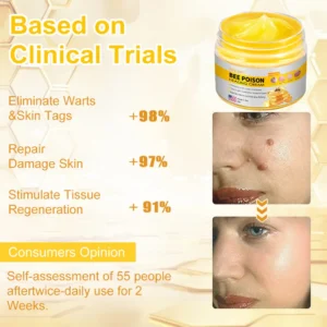 NESLEMY™ Bee Venom Skin Cream（👨‍⚕AAD Recommended)