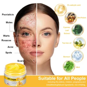 NESLEMY™ Bee Venom Skin Cream（👨‍⚕AAD Recommended)