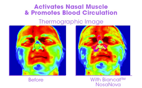NosaNova Nose Sculpting Device