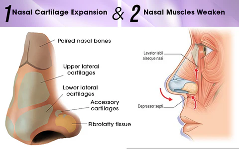 NosaNova Nose Sculpting Device