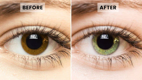 Nurbini™ Eye Drops
